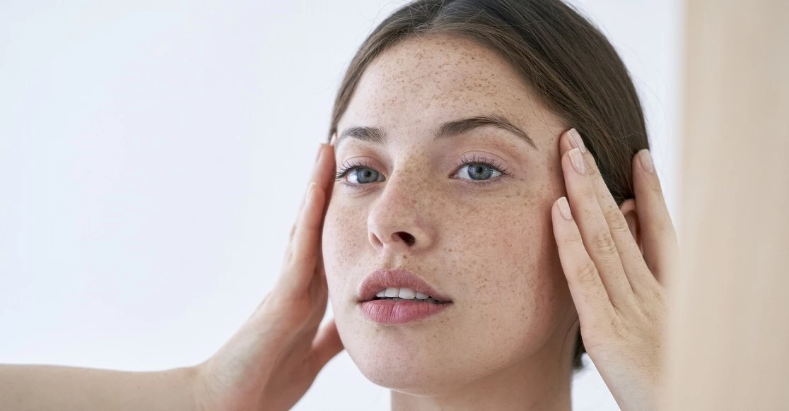 5 τοπικές θεραπείες που "φωτίζουν" αμέσα τις καφέ κηλίδες