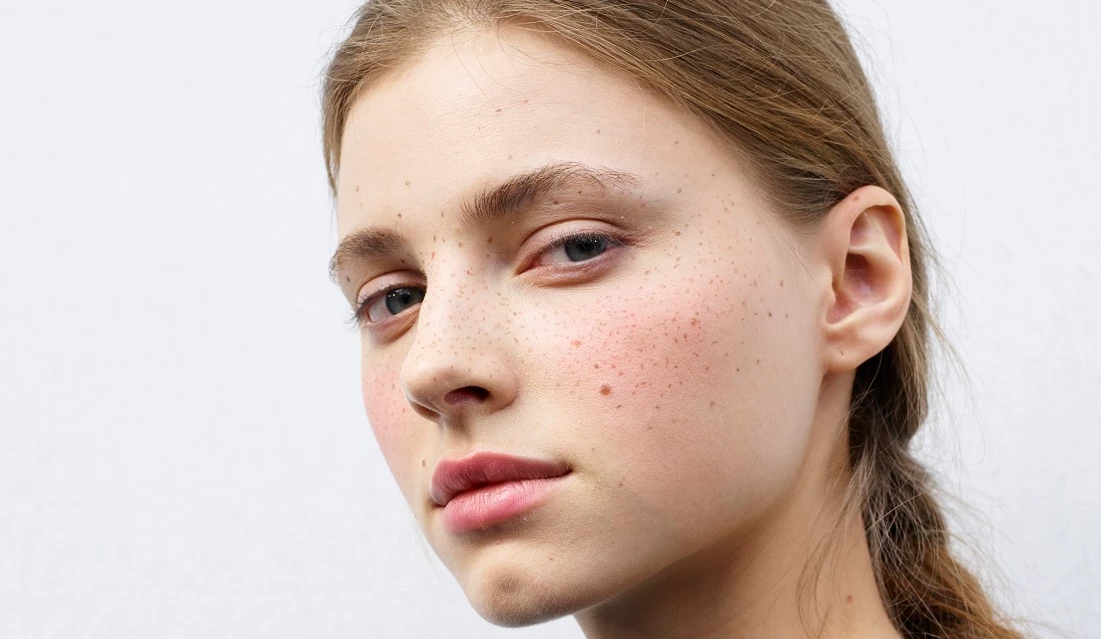 Ντεμακιγιάζ προσώπου | 4 λάθη που καταστρέφουν την επιδερμίδα