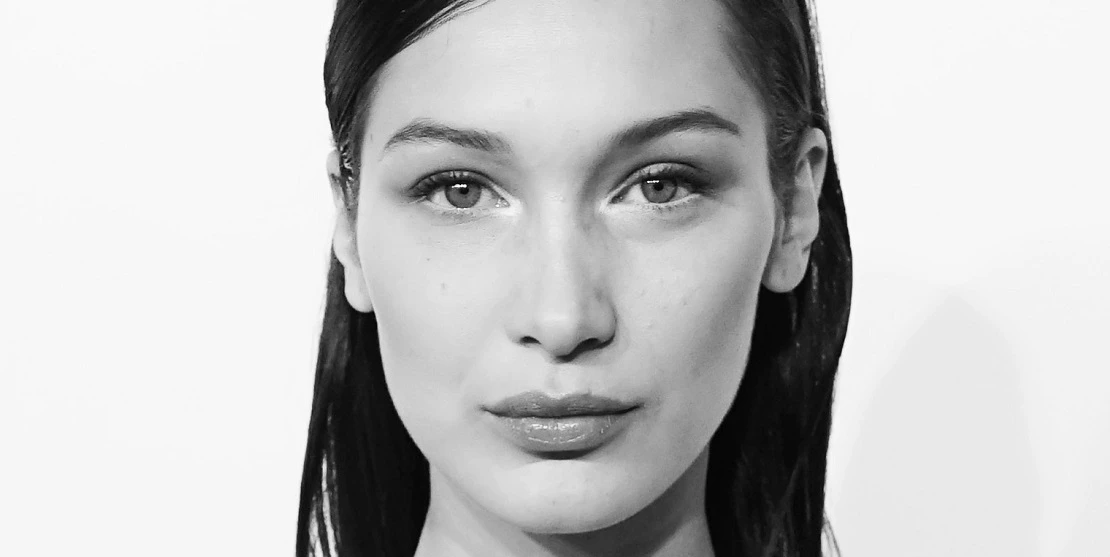 To Botox or not to Botox | Οι ερωτήσεις που πρέπει να κάνετε στο γιατρό σας