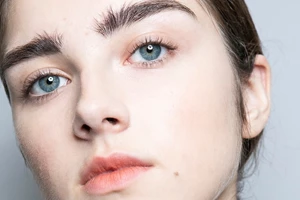 Πώς να απαλλαγείτε από τα σημάδια της ακμής μια για πάντα