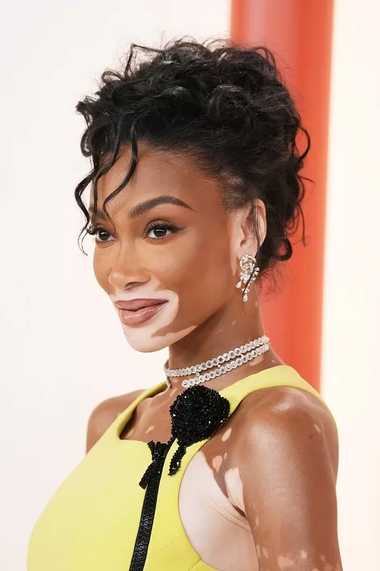 Winnie Harlow