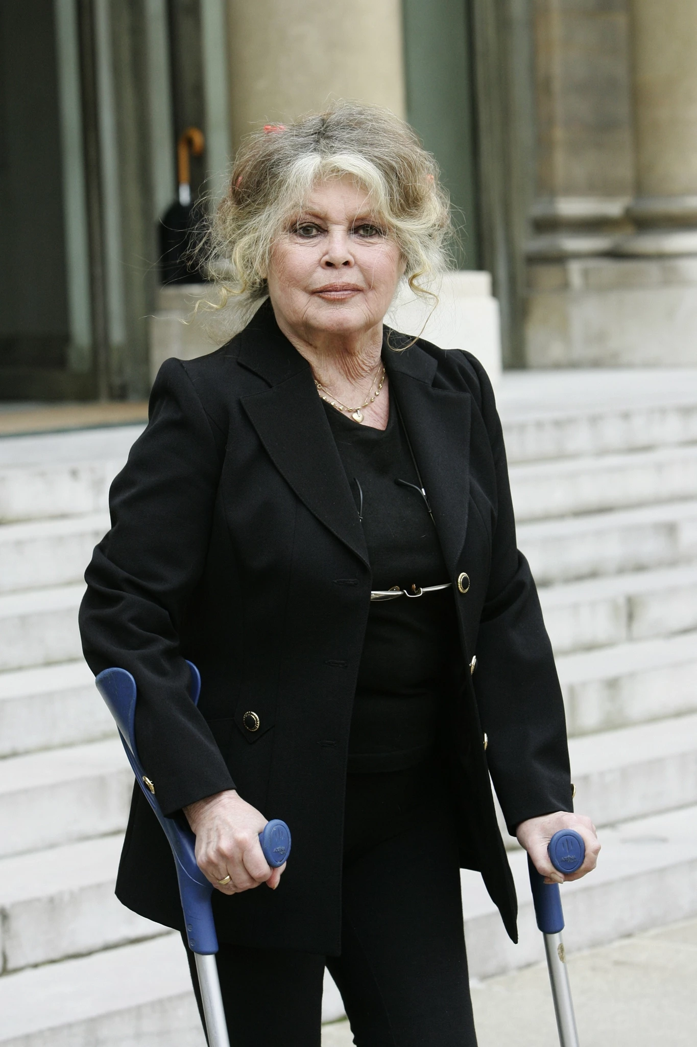 Brigitte Bardot | Η κατάσταση της υγείας της μετά την εισαγωγή στο νοσοκομείο