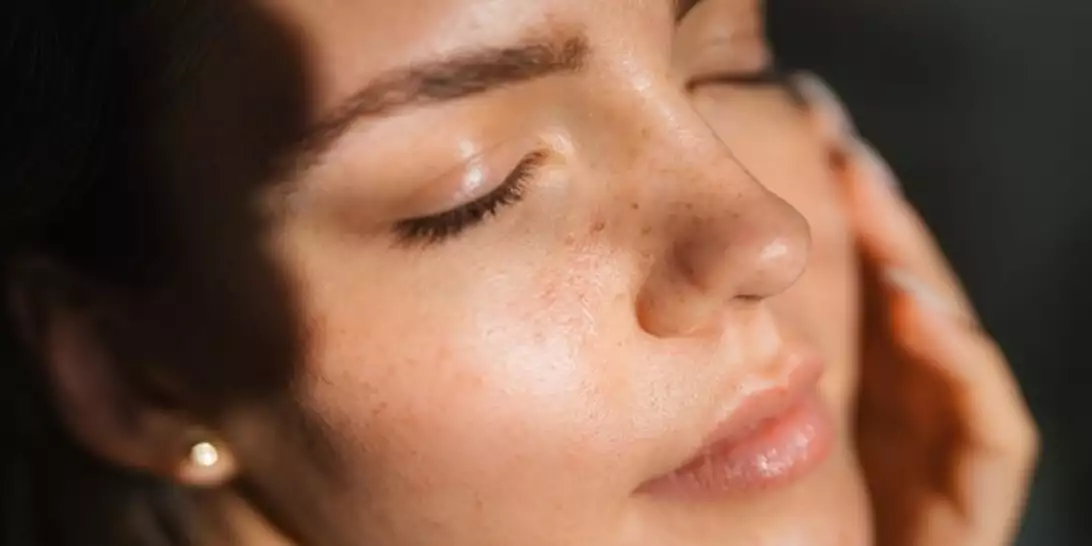 Πανάδες | Πώς θα ξαναβρείτε την καθαρή, λαμπερή σας επιδερμίδα