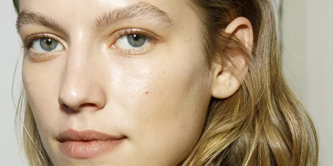 Καφέ Κηλίδες | Πως θα αποτρέψετε την εμφάνισή τους αυτό το καλοκαίρι