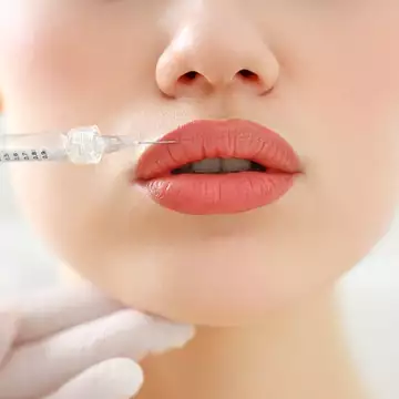 Fillers | Πώς θα διαρκέσουν περισσότερο στο πρόσωπο;