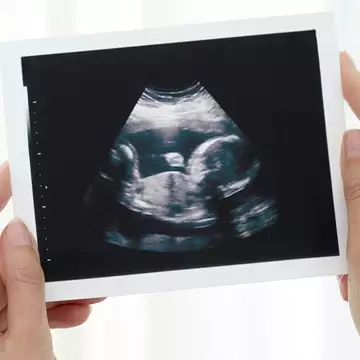 Δύο χρόνια "Ελπίδας ζωής" γεμάτα νέα παιδικά χαμόγελα