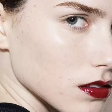 Ρινοπλαστική σε κάθε ηλικία