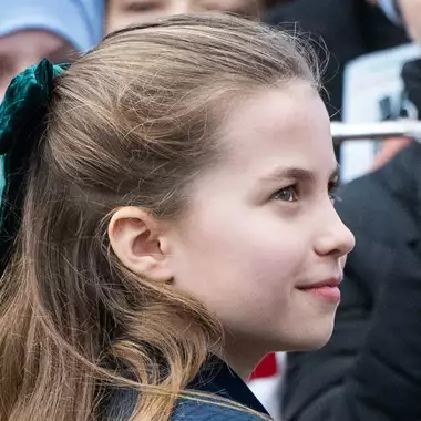 Πριγκίπισσα Charlotte | Το στοιχείο στην εξωτερική της εμφάνιση για το οποίο μιλούν όλοι