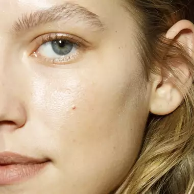 Καφέ Κηλίδες | Πως θα αποτρέψετε την εμφάνισή τους αυτό το καλοκαίρι